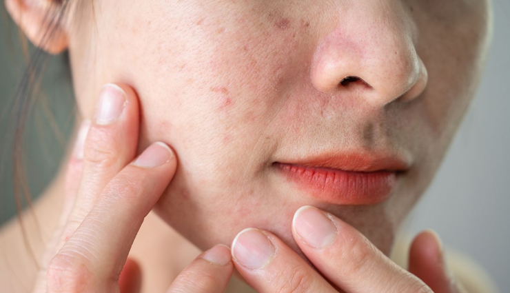 9 Foods You Can Eat To Improve Your Skin Texture