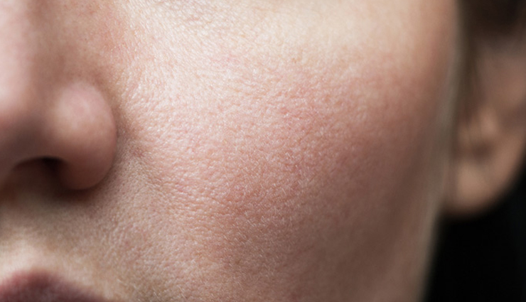 salicylic acid benefits for skin,amazing skin benefits of salicylic acid,using salicylic acid for skincare,salicylic acid for clear skin,benefits of salicylic acid for acne-prone skin,salicylic acid for exfoliation,incorporating salicylic acid into skincare routine,clearing blemishes with salicylic acid,salicylic acid and skin renewal,salicylic acid properties for healthy skin