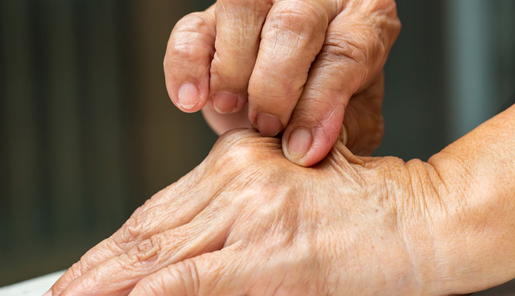 What Is Skin Turgor? Understanding and Treating Poor Skin Turgor