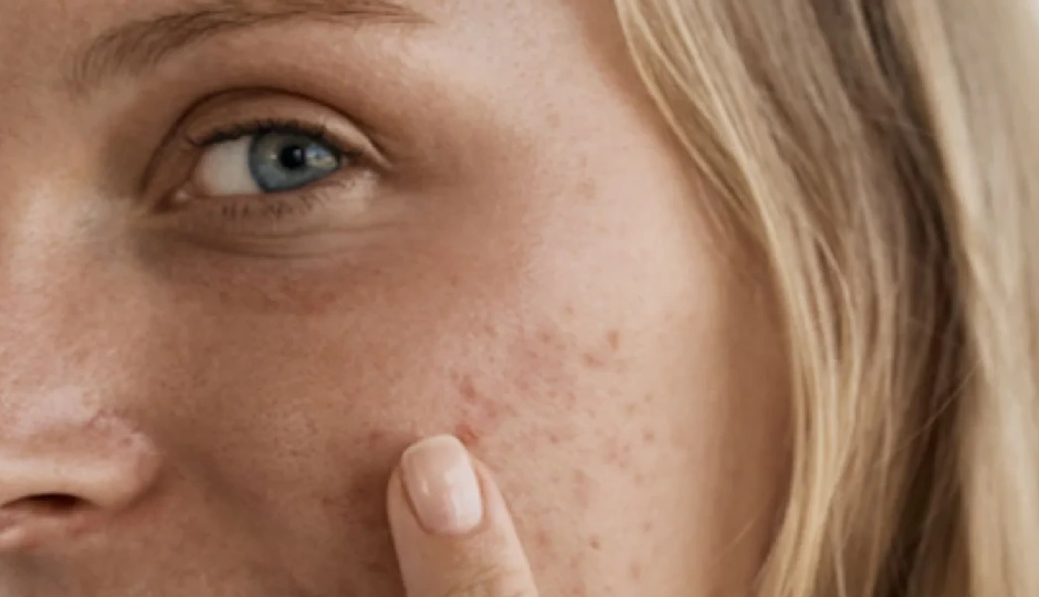 घर पर ऐसे पहचानें अपना स्किन टाइप, सही प्रोडक्ट चुनना हो जाएगा बेहद आसान