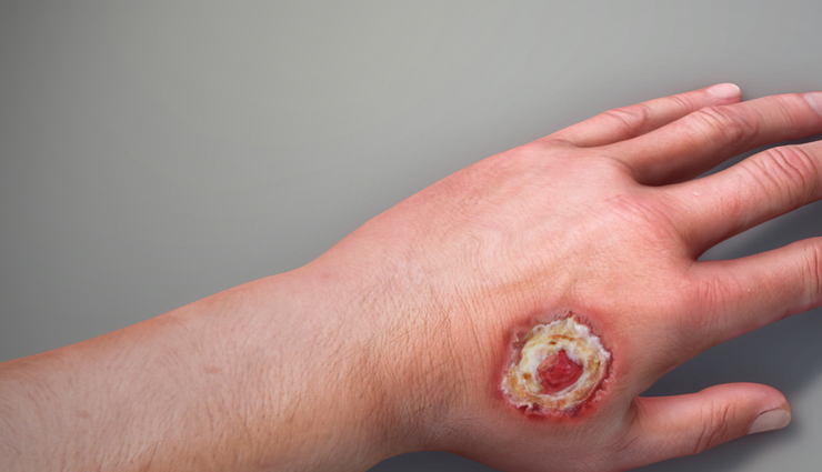 beauty benefits of tulsi leaves,tulsi leaves benefits,beauty tips,beauty hacks,tulsi plant,ayurvedic benefits of tulsi