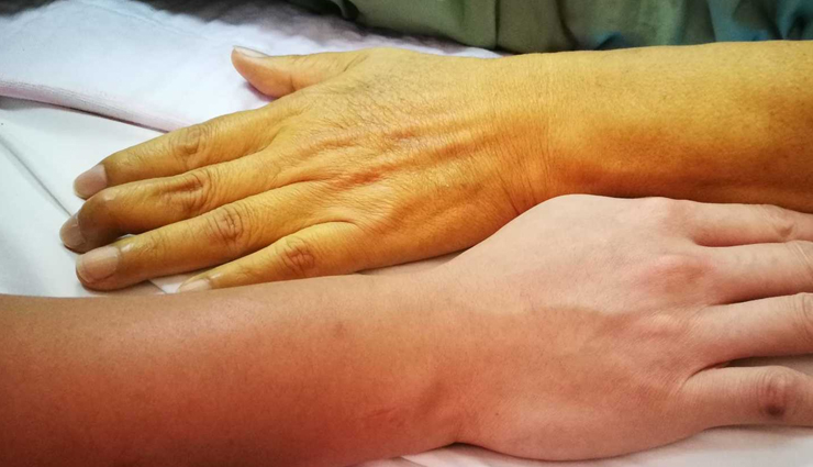 skin,vitamin b 12 for skin,vitamin b 12 deficiency,skin care tips,skin itching,skin itching and burning,dislocated and dry skin,acne spots and pimples,skin itching and burning,red patches and irritation in the skin,skin yellowing,beauty,beauty tips