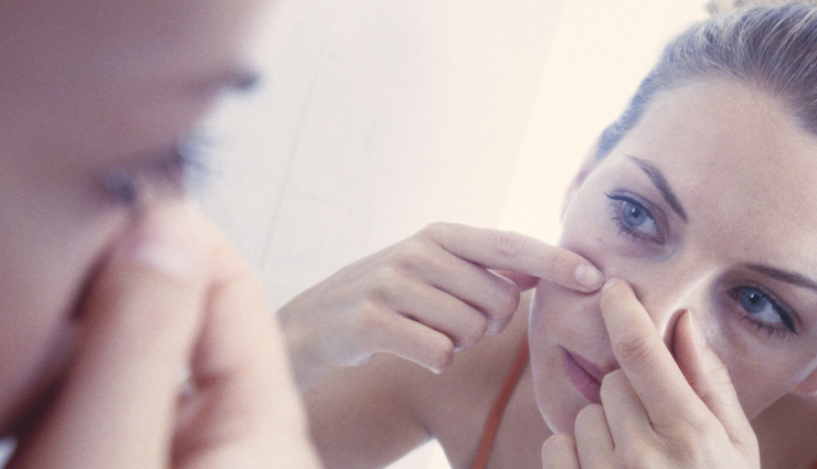 mistakes in skincare,mistakes to avoid for acne,acne care tips,beauty tips,skin care tips