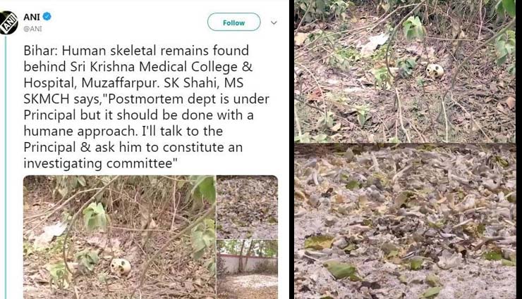 acute encephalitis syndrome,muzaffarpur news,sri krishna medical college and hospital,aes,skmch,human skeletal,chamki bukhar,chamki fever,bihar news,nitish kumar,news,news in hindi