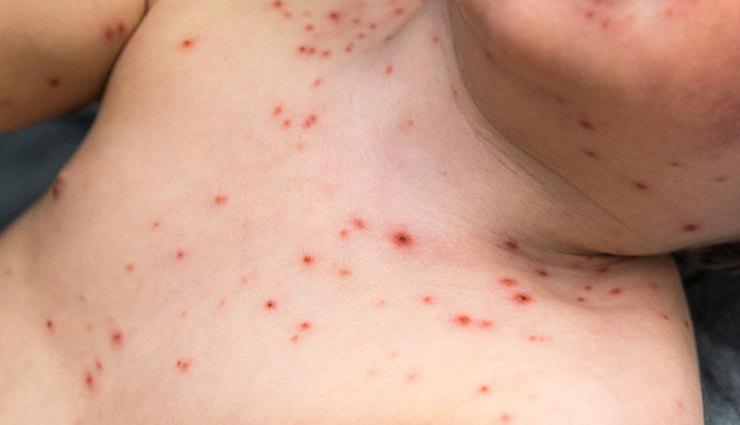 coriander,coriander good for health,coriander health benefits,health benefits of coriander,healthy food coriander,Health tips,Health