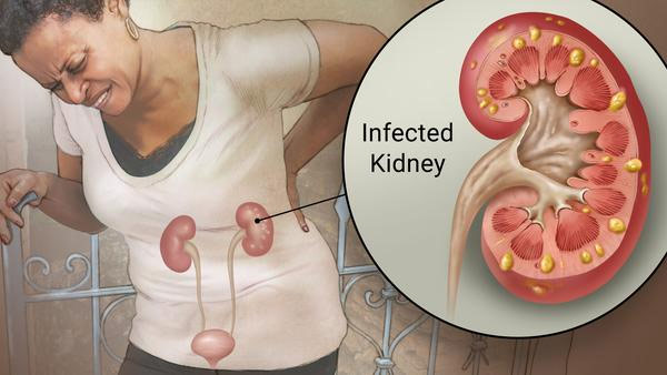 world no tobacco day 2018,smoking,smoking effects on kidney,research