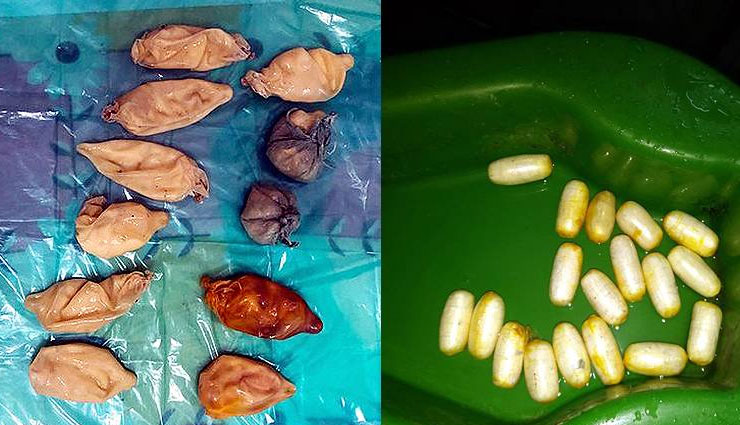 man,woman,arrested,mumbai,banglore,airport,smuggling,drugs,private,parts,weird news