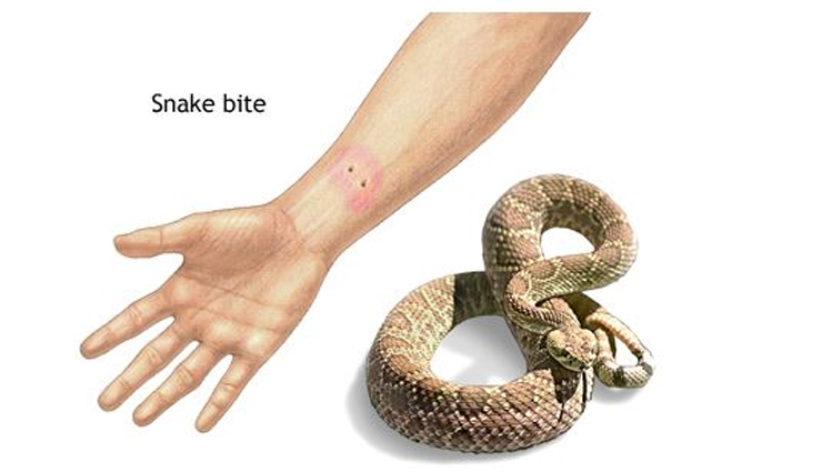 Health tips,healthy living,understanding basic first aid,how to give basic first aid,basic first aid during accidents,first aid tips