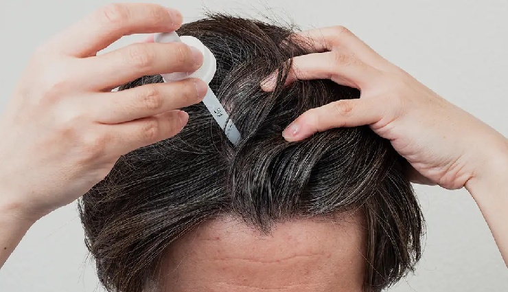 hair loss treatment,hair thinning remedies,hair regrowth solutions,male pattern baldness,female hair loss,causes of hair fall,hair fall prevention,hair health tips,hair growth tips,natural remedies for hair loss,alopecia treatment