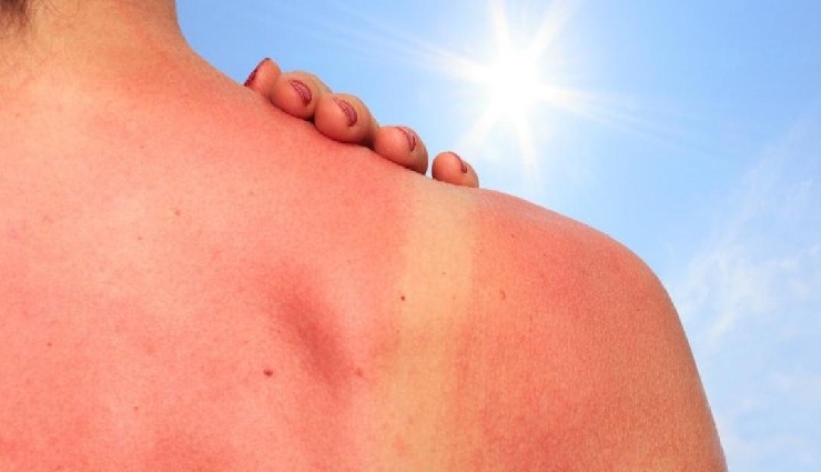 black gram benefits,urad dal health benefits,black gram for skin,urad dal for hair growth,natural skin exfoliant,black gram face pack,urad dal uses,protein-rich dal,benefits of urad dal,natural hair care,skin care with black gram,indian home remedies,urad dal powder for skin,healthy hair tips,glowing skin home remedies