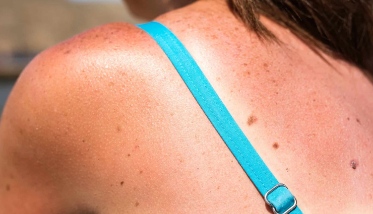 oats oil benefits,oats oil for skin,oats oil properties,oats oil skincare,moisturizing properties of oats oil,soothing effects of oats oil,antioxidant-rich oats oil,oats oil for sensitive skin,exfoliating benefits of oats oil,oats oil for dry skin,oats oil for eczema,oats oil for psoriasis,oats oil for dermatitis,oats oil for itching,oats oil for skin barrier,skin hydration with oats oil,oats oil in cosmetics,oats oil for radiant skin,anti-inflammatory oats oil,natural skincare with oats oil