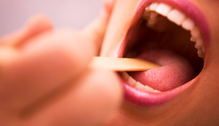 slippery elm,benefits of slippery elm,slippery elm benefits,calcium,iron,magnesium,manganese,phosphorus,potassium,selenium,zinc,beta-carotene