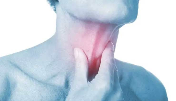 बारिश के दिनों में होती है गले में खराश, इन नुस्खों की मदद से मिलेगी राहत 