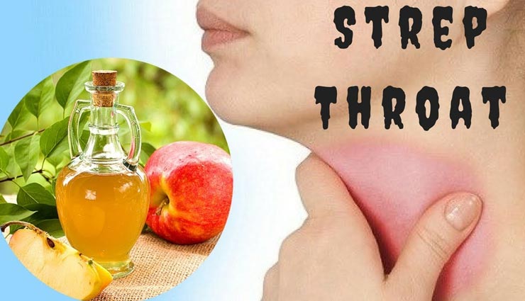 एप्‍पल साइडर विनेगर करेगा गले की खराश का इलाज, जानें तरीके