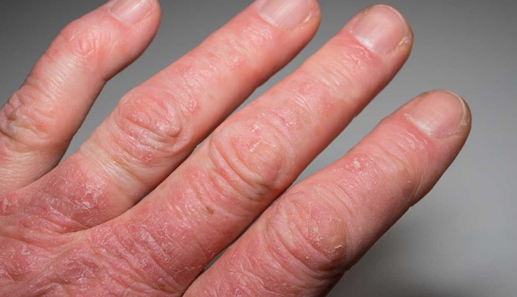 health benefits of sour cherry,sour cherry,Health tips,fitness tips