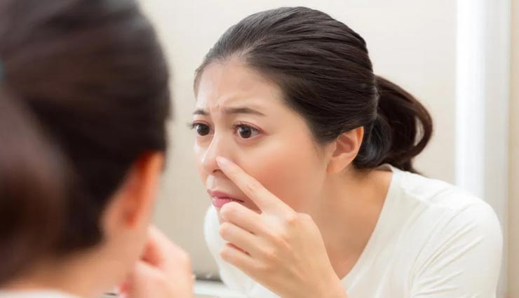 क्या आपकी नाक पर भी पड़ने लगे हैं चश्मे के निशान, इन तरीकों से करें इन्हें दूर