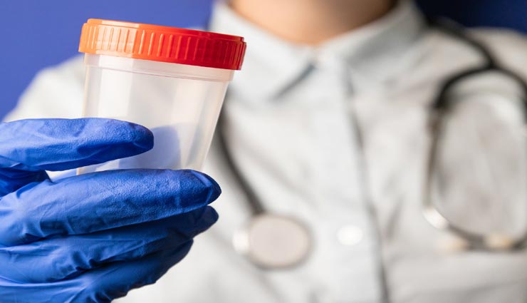 weird news,weird information,sperm donor,sperm donor conditions