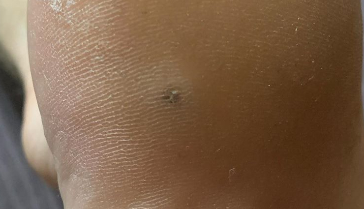 garlic,health benefits of garlic,garlic healthy food,garlic for good health,Health,Health tips