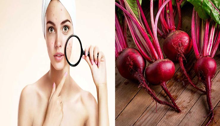 beauty tips,beauty tips in hindi,beauty by beetroot,natural beauty tips,skin care tips,beautiful face
