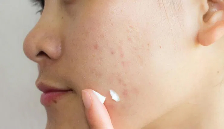 skincare products,use of skin care products,beauty,skin care tips,beauty tips