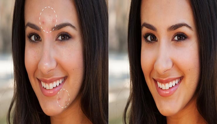 रखते हैं चमकदार त्वचा की चाहत, ये प्राकृतिक नुस्खे आएंगे बहुत काम