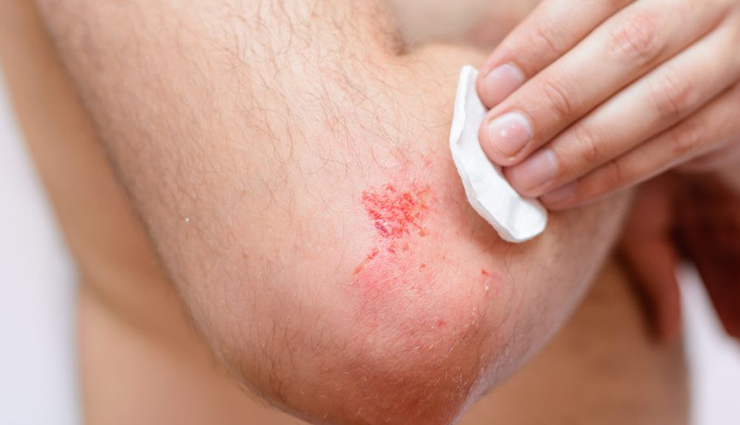 health benefits of mung bean sprouts,Health tips,fitness tips,mung bean sprouts