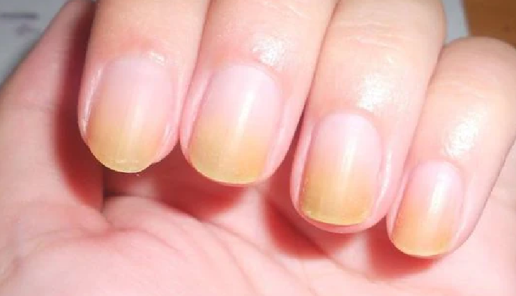 nail polish impact on nails,effects of wearing nail polish,nail polish consequences on nails,what happens to nails with nail polish,nail polish and nail health,nail polish damage to nails,nail enamel impact on nails,consequences of frequent nail polish use,nail polish side effects,nails after prolonged nail polish wear,long-term effects of nail lacquer,health risks of continuous nail polish application,nail polish wear and tear on nails,nail polish residue effects,nail health and polish use consequences