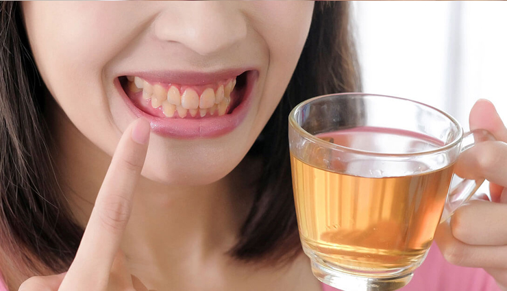 causes of yellow teeth,yellow teeth causes,teeth discoloration,tooth staining reasons,discolored teeth,aging teeth,foods that stain teeth,tobacco use and yellow teeth,medications that cause yellow teeth,genetics and yellow teeth,health conditions and yellow teeth,home remedies for yellow teeth,natural teeth whitening methods,teeth whitening at home,diy teeth whitening,baking soda for teeth whitening,hydrogen peroxide for teeth whitening,charcoal teeth whitening,apple cider vinegar for teeth whitening,oil pulling for teeth whitening,lemon and salt for teeth whitening,strawberry teeth whitening