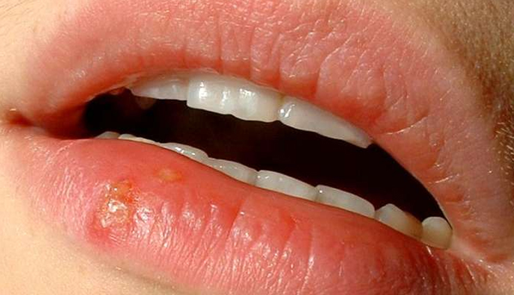 figs,health benefits of figs,figs for good health,healthy food figs,figs for good health,healthy food figs for body,body care,healthy food,healthy living,Health tips