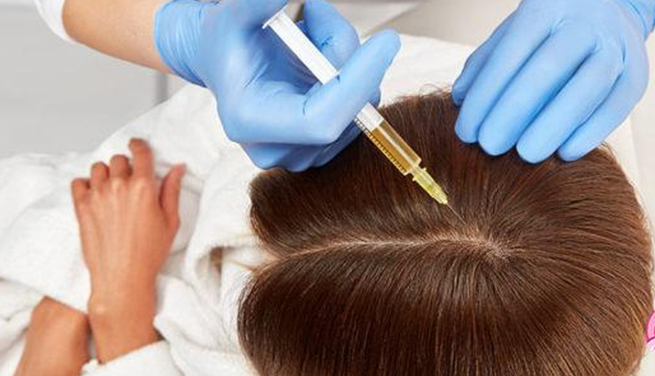 cell therapy for hair baldness,stem cell therapy for hair baldness,hair baldness,hair fall problem,stress,dandruff,weak hair,hair loss,beauty,beauty tips