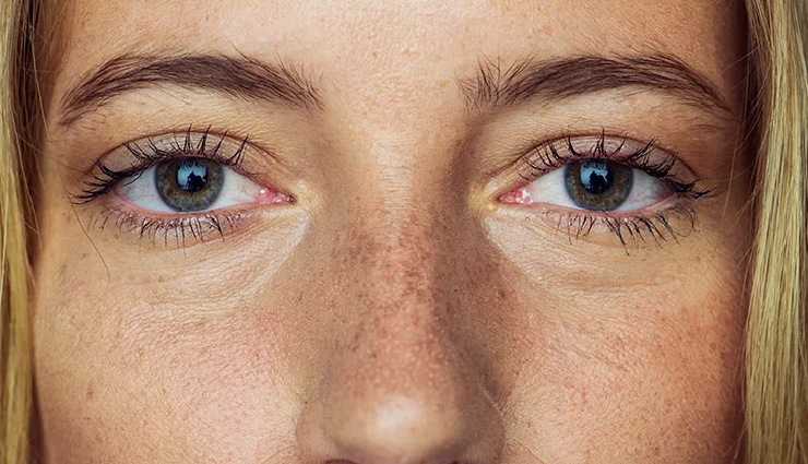 ingredients to avoid under eyes,skincare ingredients to avoid near eyes,synthetic fragrance dangers for eyes,steroids under eyes risks,alcohol effects on under-eye skin,salicylic acid under-eye precautions,formaldehyde in eye skincare,eye cream ingredient warnings,delicate skin around eyes,under-eye skincare precautions