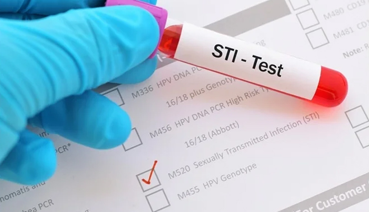 सेक्स के बाद यूरिन पास करना जरुरी है या नहीं, क्या रोका जा सकता है प्रेग्नेंसी को?, जानें क्या कहते हैं एक्सपर्ट्स intercourse,pee,peeing after intercourse,expert advice,Health,health news,healthy living,why should you urinate after intercourse,should i pee after intercourse if trying to get pregnant,how long should i lie down after intercourse to get pregnant,does urine flush out sperm,why do sperm come out immediately after intercourse,is it normal for sperm to leak out after,does sperm flow out after intercourse,what time of day is sperm count highest,what are the tricks to get pregnant,how long should you keep sperm in when trying to conceive,are guys more fertile in the morning