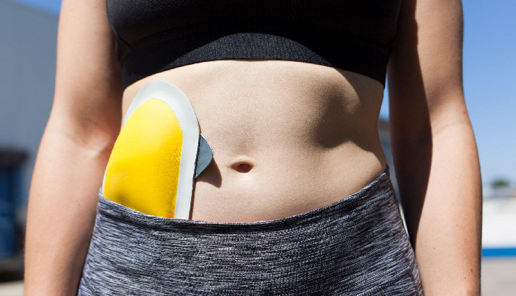 10 Most Common Stoma Issues and Complications