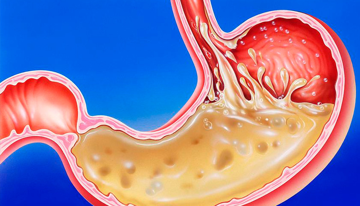 cholera,cholera causes,cholera symptoms,cholera treatment,cholera infection,what is cholera,how to get rid of cholera,Health,Health tips