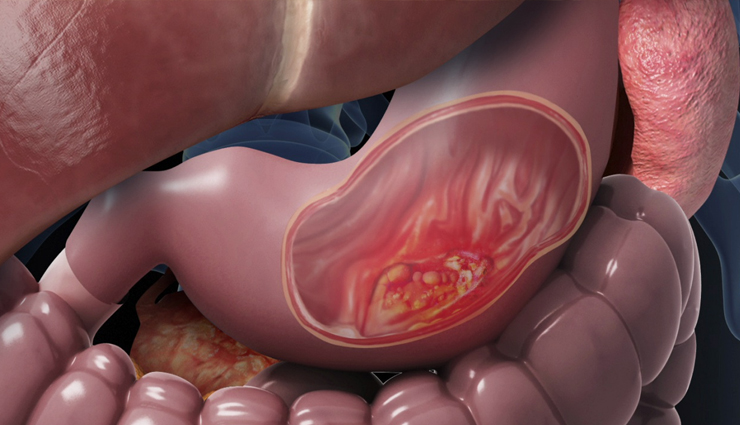 benefits of eating peanuts,peanuts benefits,health tips of peanuts,simple health tips,healthy diet