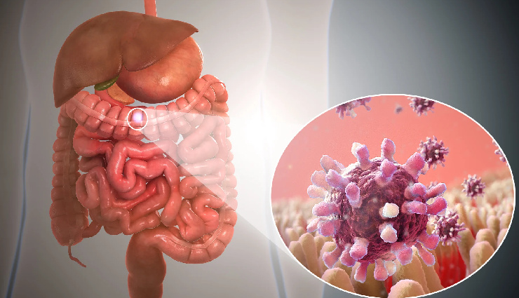 15 Foods That Will Help You Beat Stomach Flu