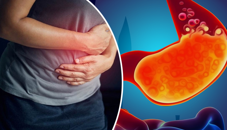 सूखे मेवों में अलग मुकाम रखता है अंजीर, इसके सेवन से दूर रहती हैं ये बीमारियाँ anjeer health benefits,benefits of eating anjeer,health advantages of anjeer,anjeer nutritional benefits,anjeer fruit benefits,anjeer for health,anjeer benefits for the body,anjeer benefits for skin,anjeer benefits for hair,anjeer for weight loss,anjeer and its health properties,anjeer benefits for digestion,anjeer for heart health,anjeer role in maintaining blood sugar levels,anjeer for bone health,anjeer and its antioxidant properties,anjeer impact on immune system,anjeer in traditional medicine,anjeer recipes for health,where to buy fresh anjeer for optimal benefits