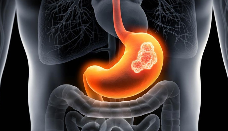 क्या आपके फ्रिज में भी आ चुकी हैं कोल्ड ड्रिंक की बोतलें? ये नुकसान जान अभी निकाल फेंकेंगे! side effects of cold drinks,health risks of cold beverages,dangers of drinking cold drinks,cold drink health issues,negative effects of cold drinks,cold drink health problems,cold drink disadvantages,harmful effects of soft drinks,cold drinks and dental health,impact of cold drinks on digestion