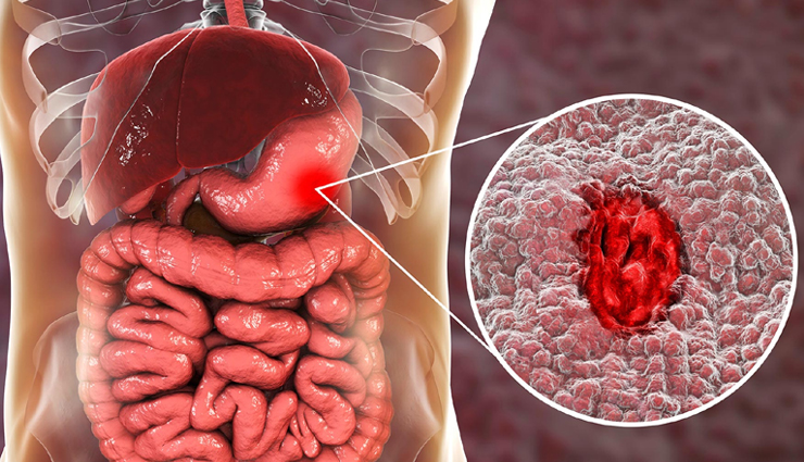 weight loss,health weight loss,health issue weight loss,Health tips,Health