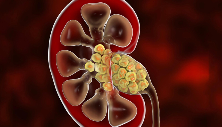 हल्दी वाला दूध: सेहत के लिए फायदेमंद, लेकिन इन लोगों को रहना चाहिए सावधान benefits of turmeric milk,who should avoid turmeric milk,turmeric milk side effects,turmeric milk for health,precautions with turmeric milk,golden milk benefits and risks,turmeric milk for immunity,who should not drink turmeric milk,health benefits of golden milk,turmeric milk safety tips.