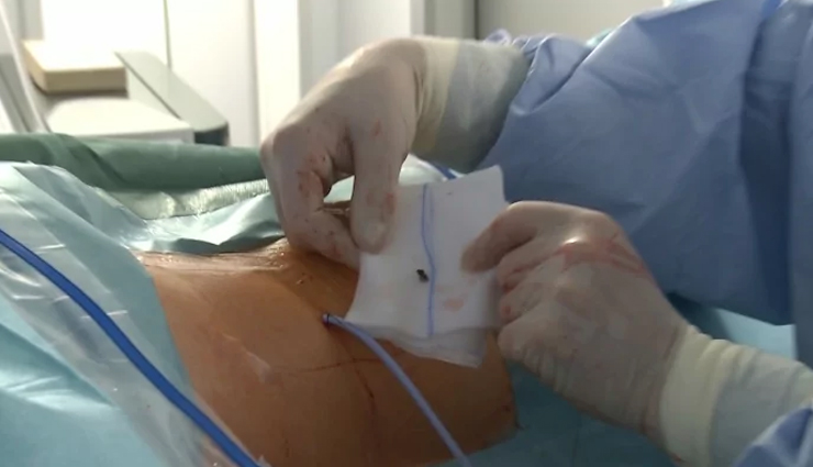 क्यूँ और कैसे होती है गुर्दे (किडनी) की पथरी, जानिये कारण और उपचार causes of kidney stones,kidney stone formation reasons,remedies for kidney stones,how to prevent kidney stones,kidney stone prevention tips