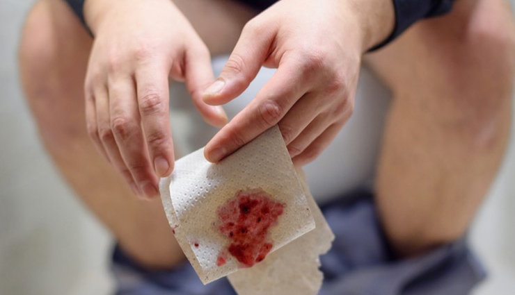 blood in stool home remedies,natural remedies for blood in stool,treating blood in stool at home,home treatments for hemorrhoids,natural remedies for anal fissures,ways to manage blood in stool,fiber for blood in stool,hydration and digestive health,witch hazel for hemorrhoids,aloe vera for rectal discomfort