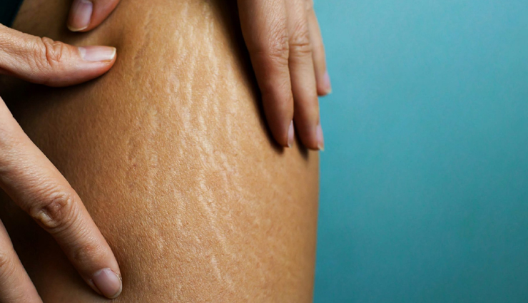 vitamin e capsules,vitamin e capsules benefits,vitamin e benefits,beauty,beauty tips