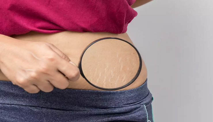 vitamin e oil,vitamin e oil benefits,vitamin e oil for skin,vitamin e oil for skin care,skin care tips,beauty tips,beauty hacks