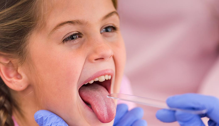 strep throat,home remedies for strep throat,throat care tips,Health tips,fitness tips