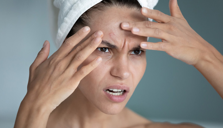 eyebrow dandruff remedies,get rid of eyebrow flakes,home remedies for eyebrow dandruff,eyebrow seborrheic dermatitis treatment,natural treatments for eyebrow dandruff,stop flaky eyebrows,tips to remove eyebrow dandruff