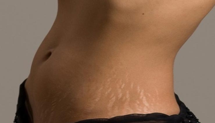 beauty tips,beauty tips in hindi,massage oil stretch marks,skin care tips