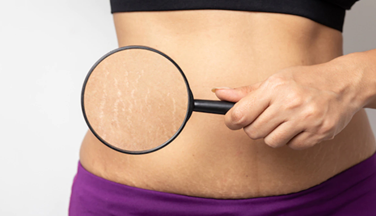 beauty tips,beauty tips in hindi,ski care tips,garlic remedies for skin