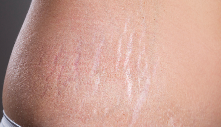 vitamin e for skin and hair,benefits of vitamin e for skin and hair,natural skin and hair care with vitamin e,antioxidant properties of vitamin e,vitamin e oil for skin and hair,vitamin e supplements for skin and hair health,vitamin e-rich foods for healthy skin and hair,vitamin e and hair growth,vitamin e and skin hydration,vitamin e and skin elasticity,vitamin e and collagen production,vitamin e and skin cell regeneration,vitamin e and sun damage protection,vitamin e and prevention of premature aging,vitamin e and dandruff prevention