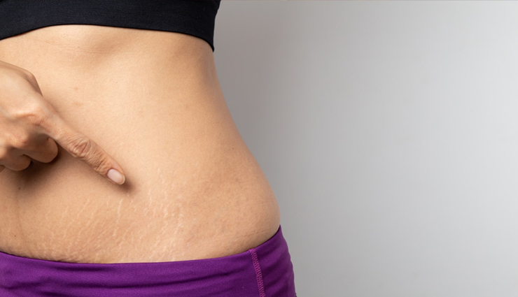 common beauty problems women face,beauty issues for women,skin problems women experience,hair problems for women,beauty struggles women encounter,common skincare concerns,hair care problems,facial skincare issues,acne and pimples in women,dry skin problems,oily skin issues for women,pigmentation problems women face,dandruff issues in women,wrinkles and fine lines,under-eye dark circles,hair thinning in women,skin redness and irritation,uneven skin tone problems,cracked heels and dry feet,body odor issues in women,hair frizz problems,common beauty challenges